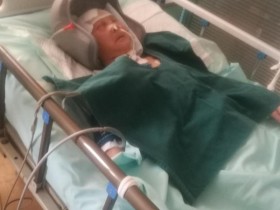 后期治疗费怎么算(后续治疗费怎么算)