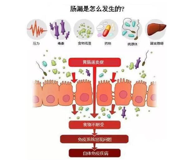 红斑狼疮会传染吗 红斑狼疮传染吗？