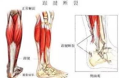 脚底凹处痛是什么原因(脚底阵痛凹处痛是什么原因)