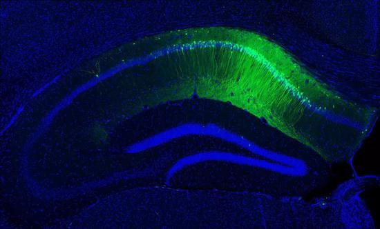 这是一幅啮齿动物脑组织（用荧光蛋白改造）切片的放大图像。图像中的绿光表明，海马体中的哪些细胞似乎在储存实验诱导所产生记忆的印迹，或者说物理痕迹。图源：Dheeraj Roy， Tonegawa Lab/MIT
